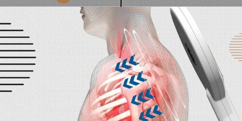 MAGREX | Estimulación magnética periférica MAGREX | Estimulación magnética periférica